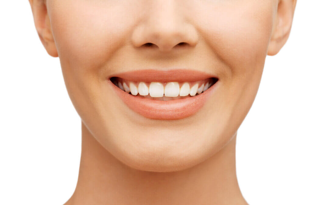 What Are the Benefits of Teeth Whitening